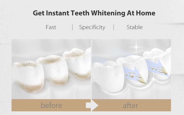 Take Home Whitening Kit