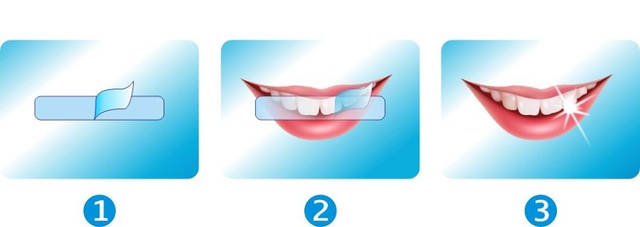 Non Peroxide Teeth Whitening Strips Private Label