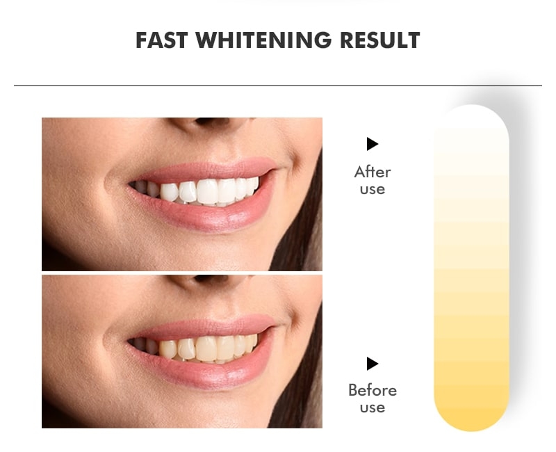 Activated Charcoal Teeth Whitening Powder