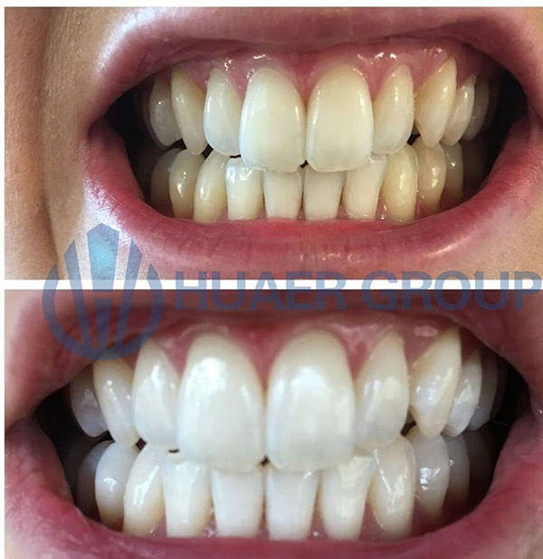 Intensive Teeth Whitening Powder