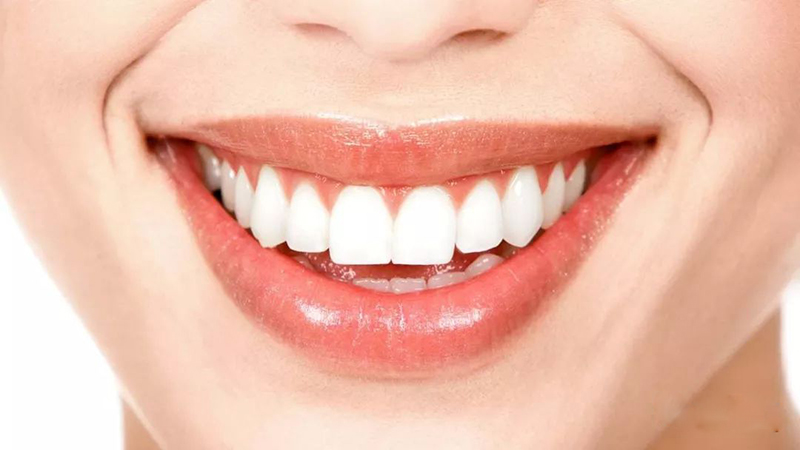 How Do Cold Light Teeth Whitening?