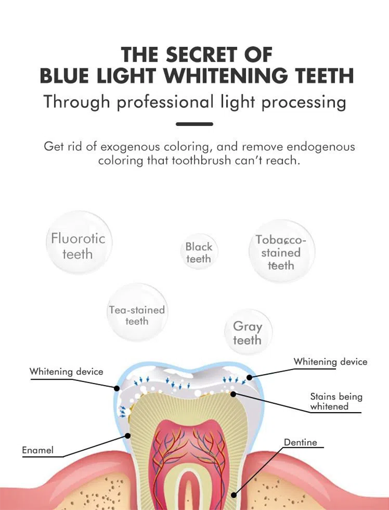 Unique Waterproof Blue Teeth Whitening Light