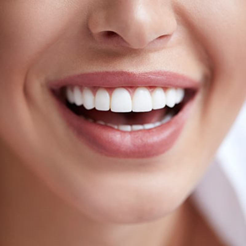 Can Sensitive Teeth Be Whitened?cid=13