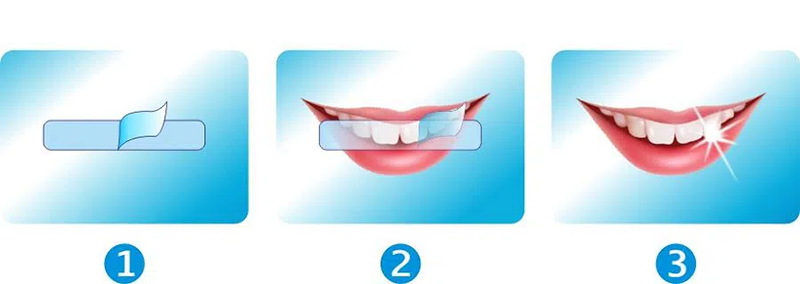 Trending Products 2022 Best Purple Teeth Whitening Strips