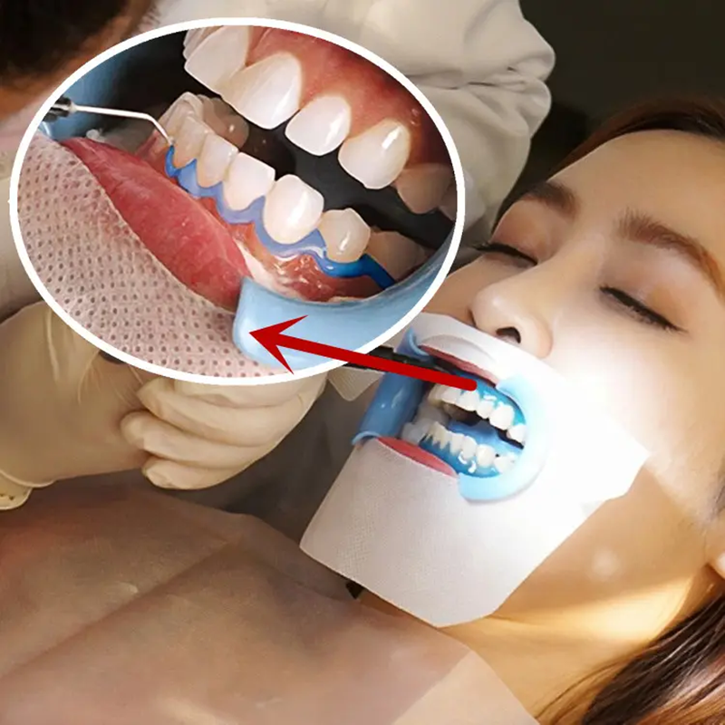 Professional Teeth Whitening Liquid and Powder Kit for Dental Clinic 5 Patients Use