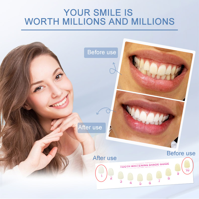 Just 30 Minutes Gel Teeth Whitening Strips-Achieve a Brighter Smile