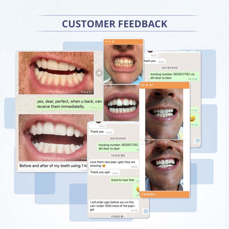 Hot High-Value Rapid Home Teeth Whitening Solution for Your Brand