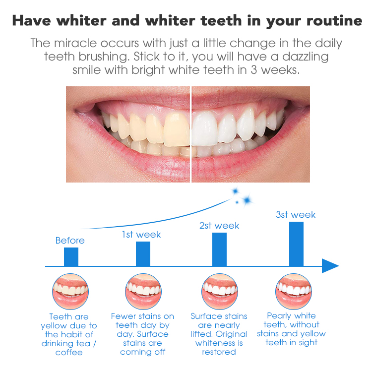 6%HP 15min Whiter Teeth Whitening Strips