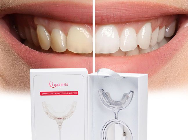 Protect Your Teeth and Smile with More Confidence