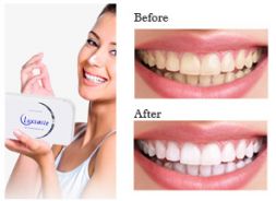 Teeth whitening Kit with OEM service