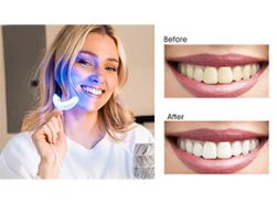 Very nice home kit teeth whitening product