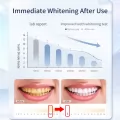 Daily Use PAP Teeth Whitening Gel Strips For Sensitive Teeth