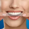 Alcohol Free Teeth Whitening Strips For the Muslim Or Alcohol Prohibited