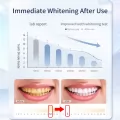 6%HP 15min Whiter Teeth Whitening Strips