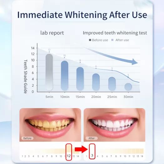 12 Shades Whiter Teeth Whitening  Strips & Device Kit