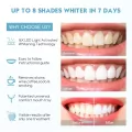 Easy to use PAP 0 Sensitive Home Teeth Whitening Kit